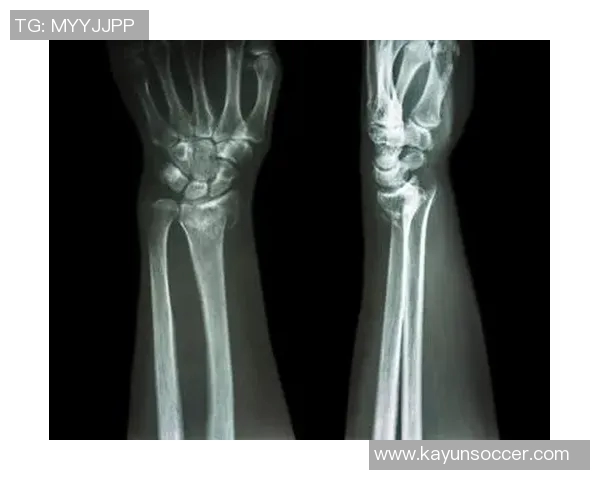 国米官方宣布迪詹纳罗右手腕骨折即将接受手术治疗